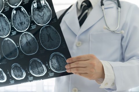 医生拿着使用钆的MRI