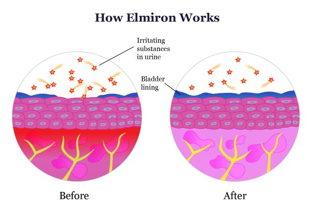 Elmiron是如何工作的