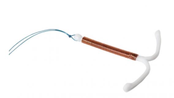 宫内节育器曼月乐IUD