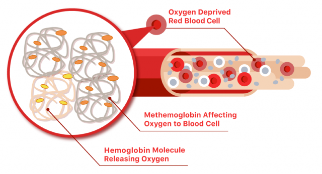 高铁血红蛋白图显示血液中低氧