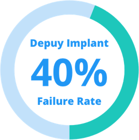 DePuy髋关节植入失败率40%