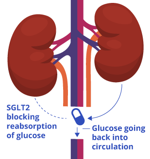 SGLT2抑制剂的工作原理示意图